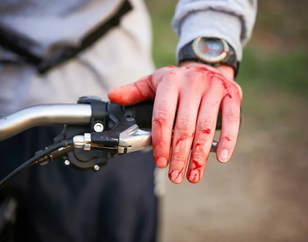 Cyklist med blod över hans händer — Stockfoto