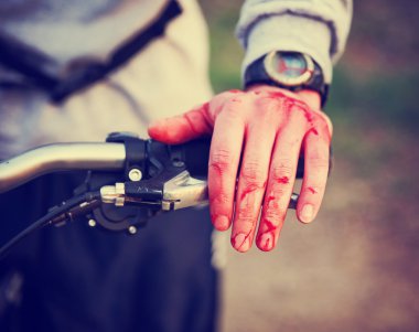 Bir dağ bisikletçinin bisikletçi wrec onun elinden kan ile