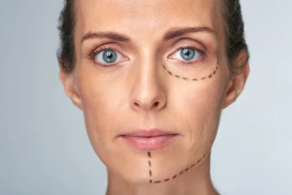 Retrato de la mujer antes de la cirugía plástica estética — Foto de Stock