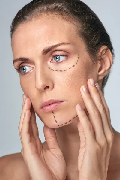 Close up of surgery lines on woman's face — Stock Photo, Image