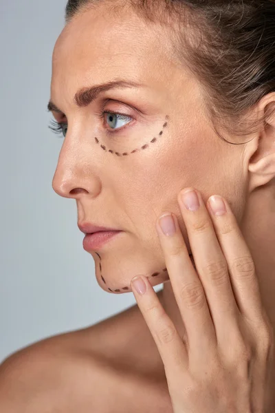 Vrouw gezicht met cosmetische chirurgie lijnen — Stockfoto