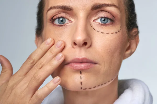 Perforación trazando líneas en la cara de la mujer antes del procedimiento — Foto de Stock