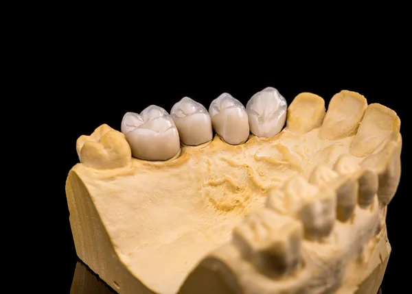 Dientes falsos, concepto dental — Foto de Stock