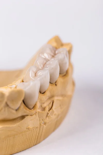 Крупный план искусственных зубов — стоковое фото