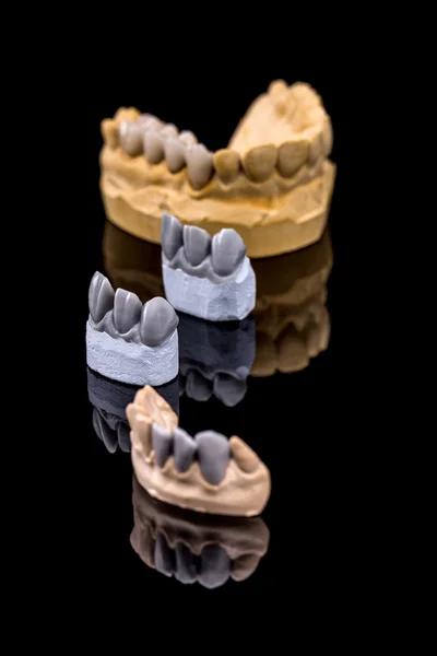 人工牙，蜡模型 — 图库照片