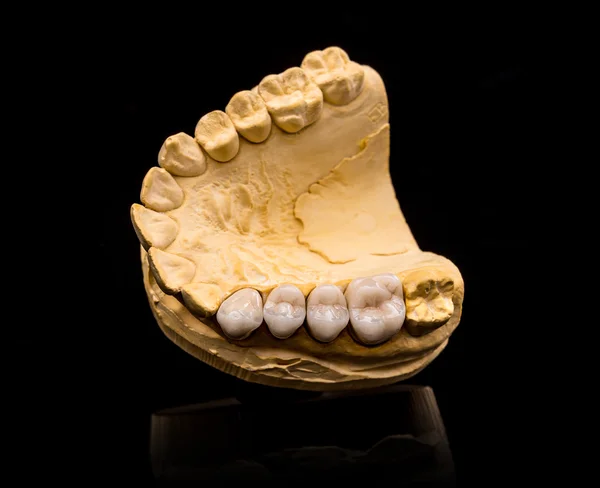 Искусственные зубы, восковые модели — стоковое фото