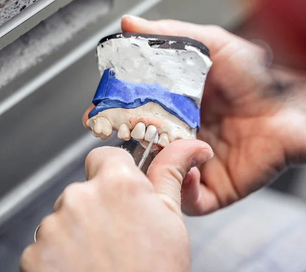 Mujer mano hacer prótesis dentales — Foto de Stock