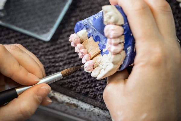 Dental technician working — Stock Photo, Image