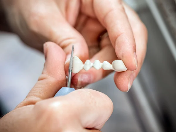 Técnico dentário moldando dentes — Fotografia de Stock