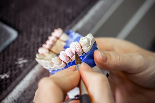 Tandteknikern arbetar — Stockfoto