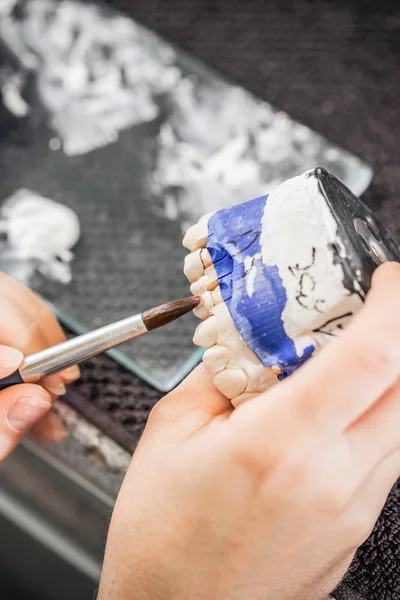 Zahntechniker bei der Arbeit — Stockfoto