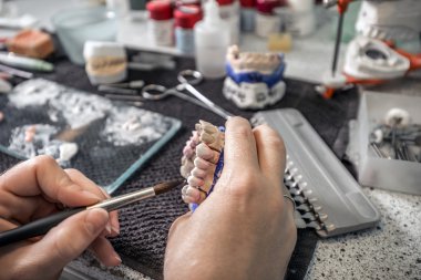 Diş teknisyeni seramik uygulama