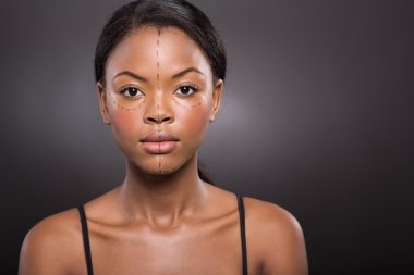 Woman before plastic surgery