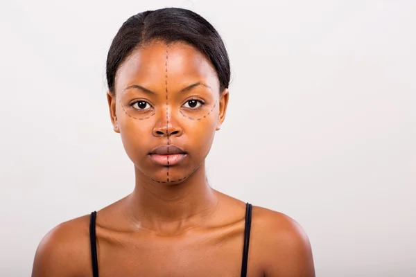 Vrouw gezicht gemarkeerd met lijnen voor cosmetische chirurgie — Stockfoto