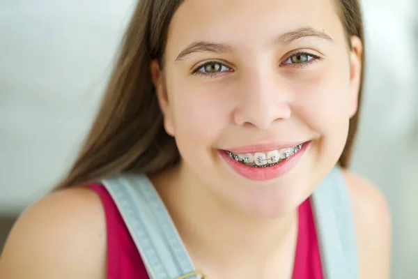 Close up retrato de menina adolescente sorridente mostrando órteses dentárias.Isolado no fundo branco. — Fotografia de Stock