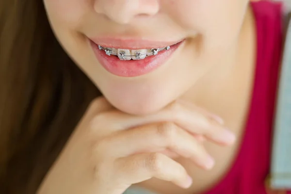 Primer plano retrato de una adolescente sonriente mostrando braces.Isolated dental sobre fondo blanco. —  Fotos de Stock