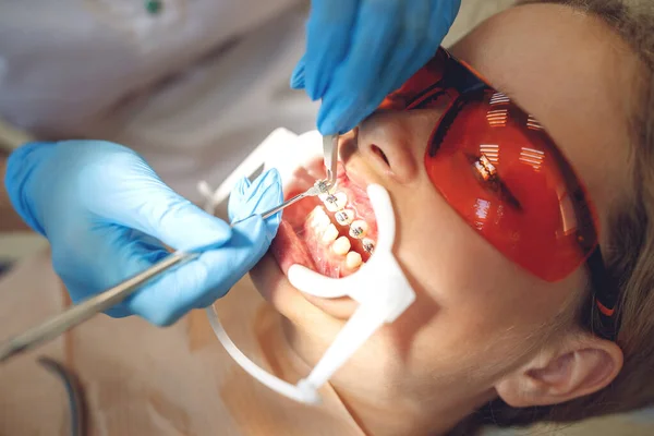 Tienermeisje met beugel op bezoek bij de orthodontist in de kliniek. Installatie van een beugelsysteem. — Stockfoto