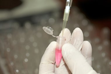 Semple pipet ile alarak