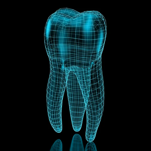 Malla dental — Foto de Stock