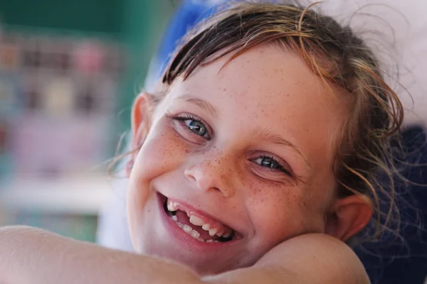 Sardento bonito menina — Fotografia de Stock