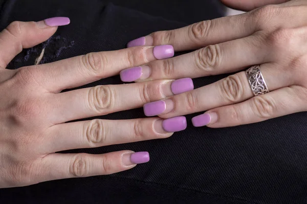 Przerośnięty Manicure Kobiece Ręce Przerośniętymi Paznokciami Czas Polerowanie Żelu Korekcyjnego — Zdjęcie stockowe