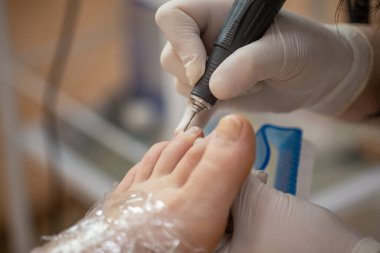 Kadın ayağı pedikür prosedürü tedavi sürecinde stok fotoğrafı