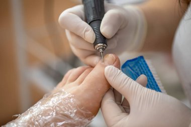 Kadın ayağı pedikür prosedürü tedavi sürecinde stok fotoğrafı