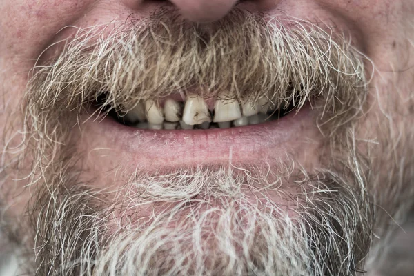 Homem com dentes manchados de tabaco — Fotografia de Stock
