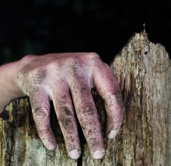 Mano sucia de un hombre en el borde de una cerca rota —  Fotos de Stock