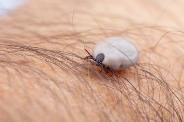 Tik (Ixodes ricinus) insan derisi kanla doludur. Tehlike böceği, Lyme hastalığının nedensel faktörleri ve kene kaynaklı beyin iltihabı gibi hem bakteriyel hem de viral patojenleri yayabilir..