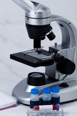 Laboratuvarda yakın planda kan olan test tüpü. Covid 19. Kan testi kavramı