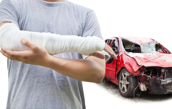 Primer plano del brazo vendado con coche destrozado azul —  Fotos de Stock