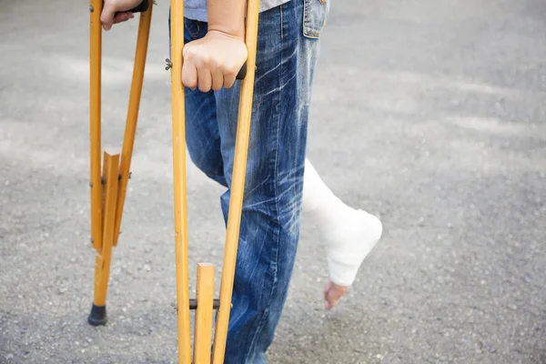 Closeup of leg on bandage with crutches — Stock Photo, Image