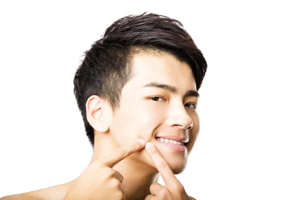 Handsome young man Squeezing pimple — Stock Photo, Image