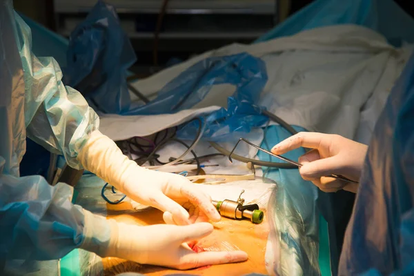 Lekarz Przeprowadzi Operację Ręce Lekarza Chirurga Zbliżenie Podczas Pracy Nowoczesna — Zdjęcie stockowe