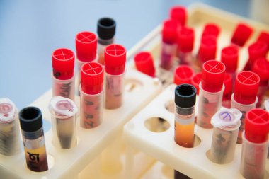 Modern tıp laboratuarı. Kanlı test tüpleri. Kan testi