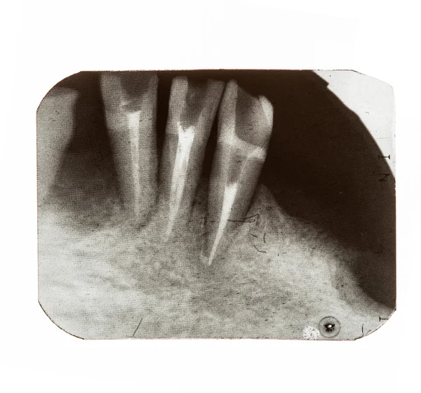 Röntgenbilder der Zähne der Patienten — Stockfoto