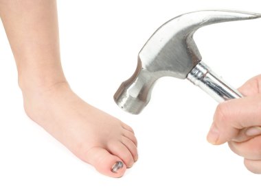 Birisi bir çocuğun ayak ile mavi hallux üzerinde çekiç tutmadığı na