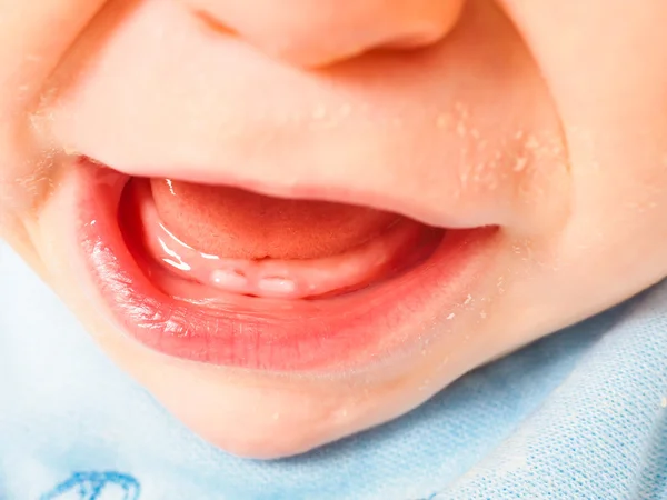 Baby boy showing first teeth — Stock Photo, Image