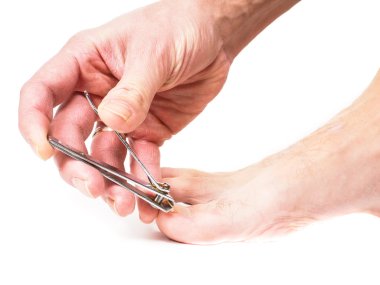 Person cutting ingrown big toe nail clipart