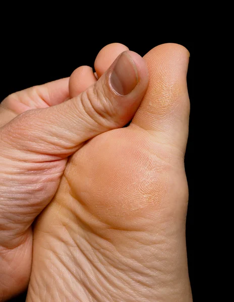 Thumb pressure on big toe massage on dry skin isolated towards b — Stock Photo, Image