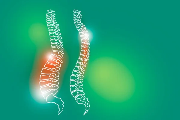 Handrawn Ilustração Coluna Vertebral Humana Fundo Verde Claro Médico Conjunto — Fotografia de Stock