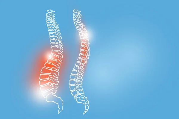 Ilustrasi Tangan Dari Spine Manusia Pada Latar Belakang Biru Muda — Stok Foto