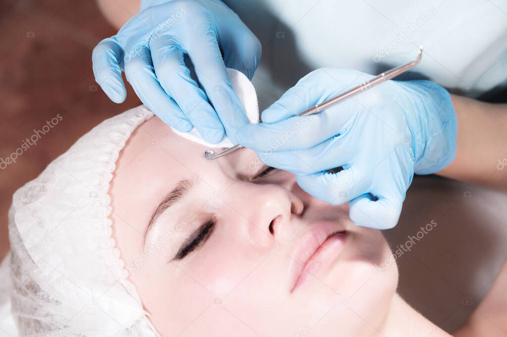 Mechanical face peel at the beautician. Beautician squeezes acne on the patients forehead with a medical needle. Face next to hands in blue gloves of cosmologist Close-up