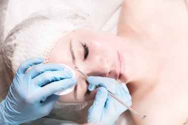 Profesyonel yüz temizleme operasyonu. Mekanik yüz temizleme prosedürü. Yüzün derisi soyuluyor..