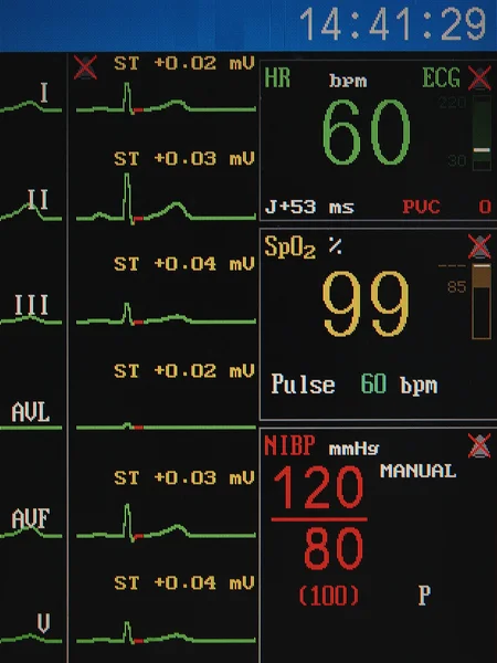 Pantalla del monitor del corazón —  Fotos de Stock