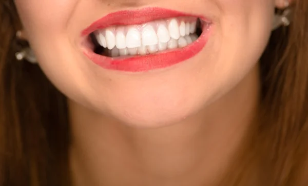 Primer plano de la boca de las mujeres jóvenes mostrando los dientes blancos sanos —  Fotos de Stock