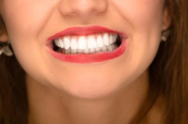 Closeup young womans mouth showing white healthy teeth — Stock Photo, Image