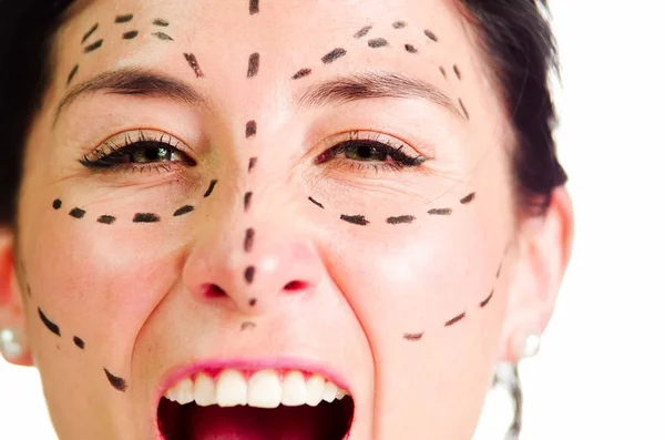 Nahaufnahme Kopfschuss kaukasische Frau mit gestrichelten Linien um das Gesicht gezeichnet Blick in die Kamera, Vorbereitung kosmetischer Chirurgie, schreiender Gesichtsausdruck — Stockfoto