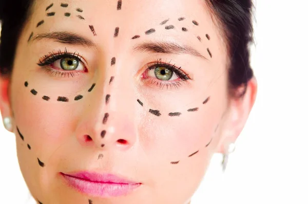 Closeup headshot Kaukasische vrouw met stippellijnen getekend rond gezicht op zoek naar camera, voorbereiding van cosmetische chirurgie — Stockfoto